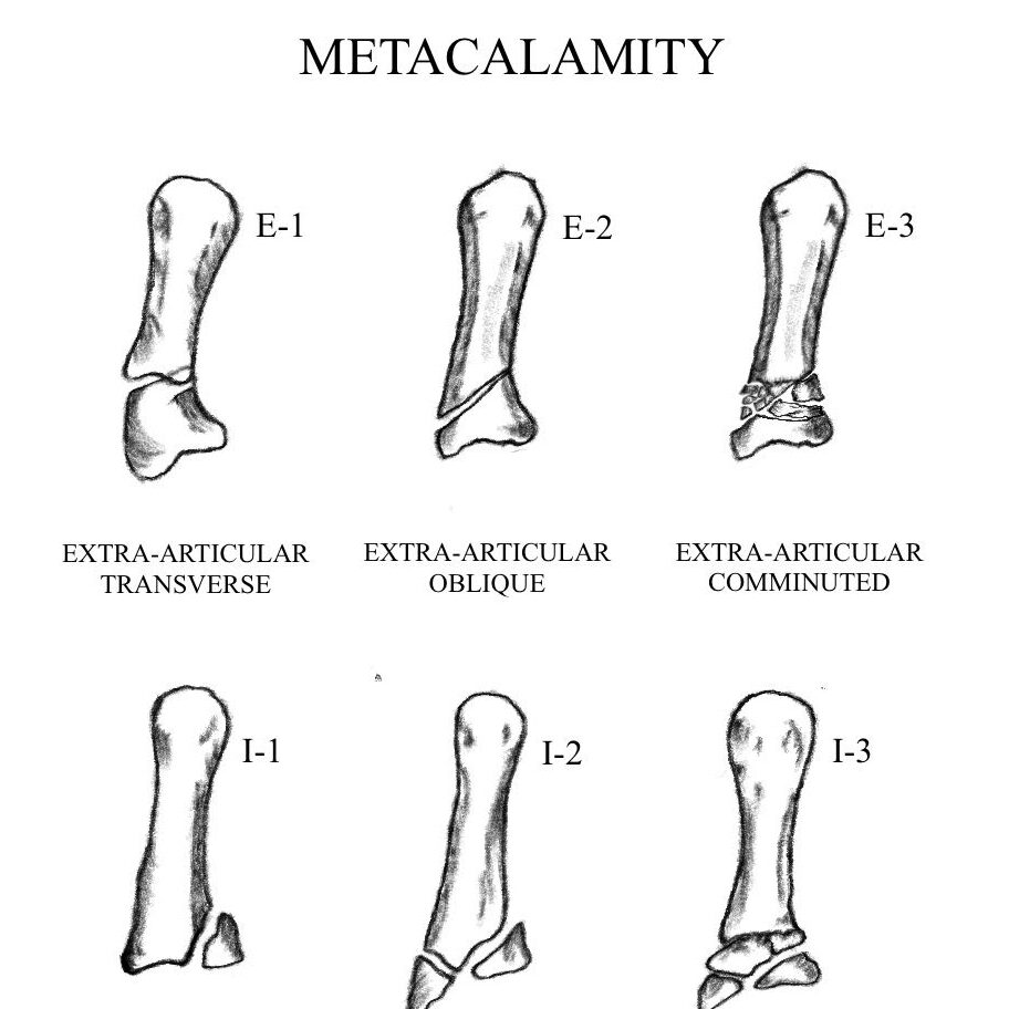 Klinický přesah a inovace - metacalamity classification